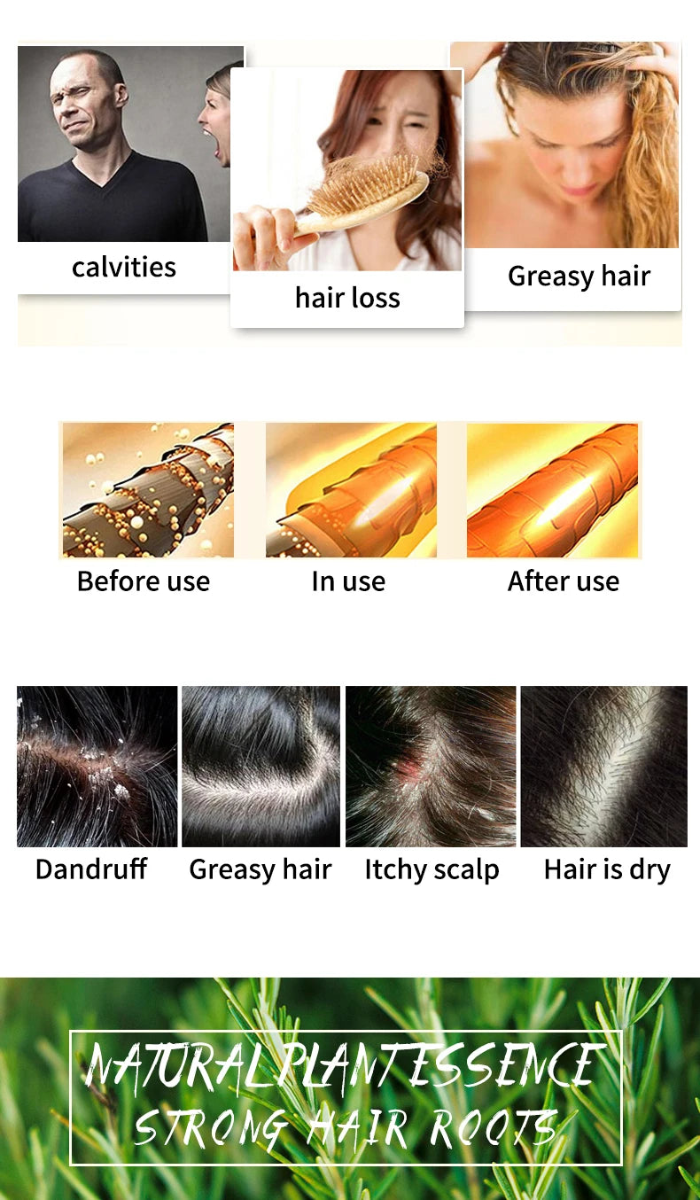 Rosemary Shampoo Bar – Silicone-Free Plant Shampoo Soap | Scalp-Cleansing, Oil-Control & Hair-Nourishing Solid Shampoo for All Hair Types (60g)