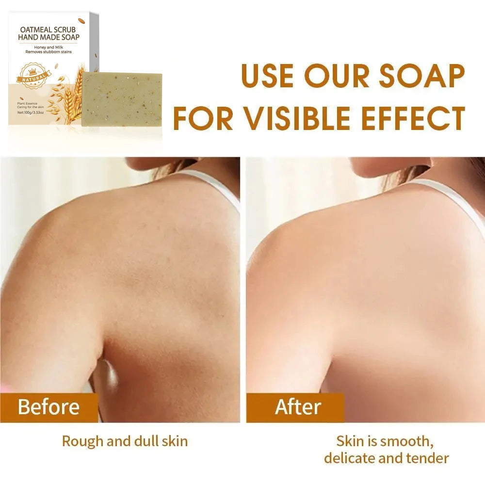 Handmade Oat Soap Bar – Natural Gentle Brightening Cleanser | Exfoliating Oat Kernel Oil Facial & Body Whitening Soap for Dark Spots & Uneven Skin Tone (100g)