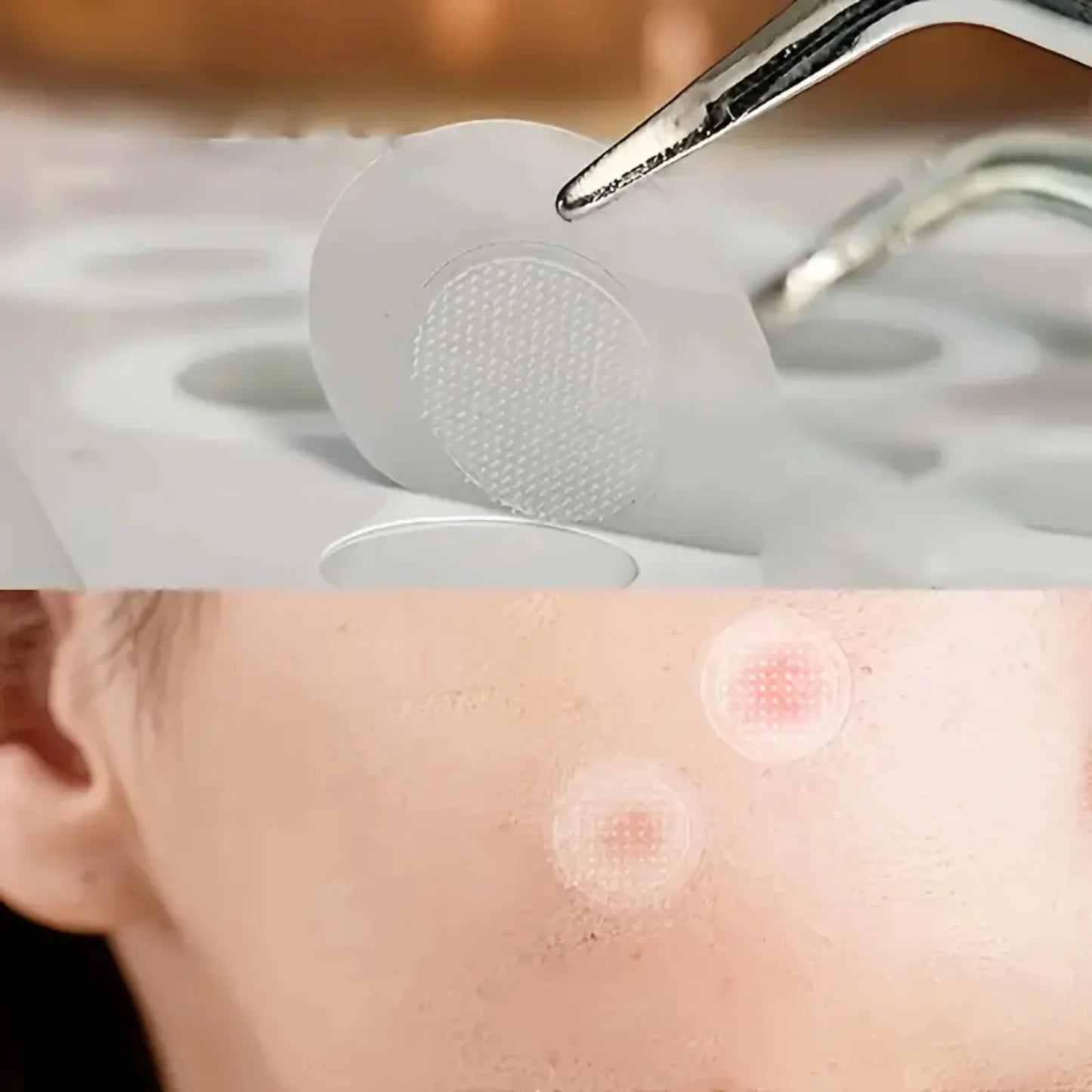 24pcs Hydrocolloid Acne Patches