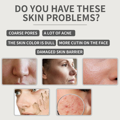 7-Second Repair Centella Asiatica Serum – Barrier-Restoring, Hydrating & Soothing Korean Facial Essence | Anti-Aging, Oil-Control & Smoothing Repair Serum (OUHOE)