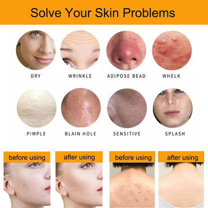 Handmade Oat Soap Bar – Natural Gentle Brightening Cleanser | Exfoliating Oat Kernel Oil Facial & Body Whitening Soap for Dark Spots & Uneven Skin Tone (100g)