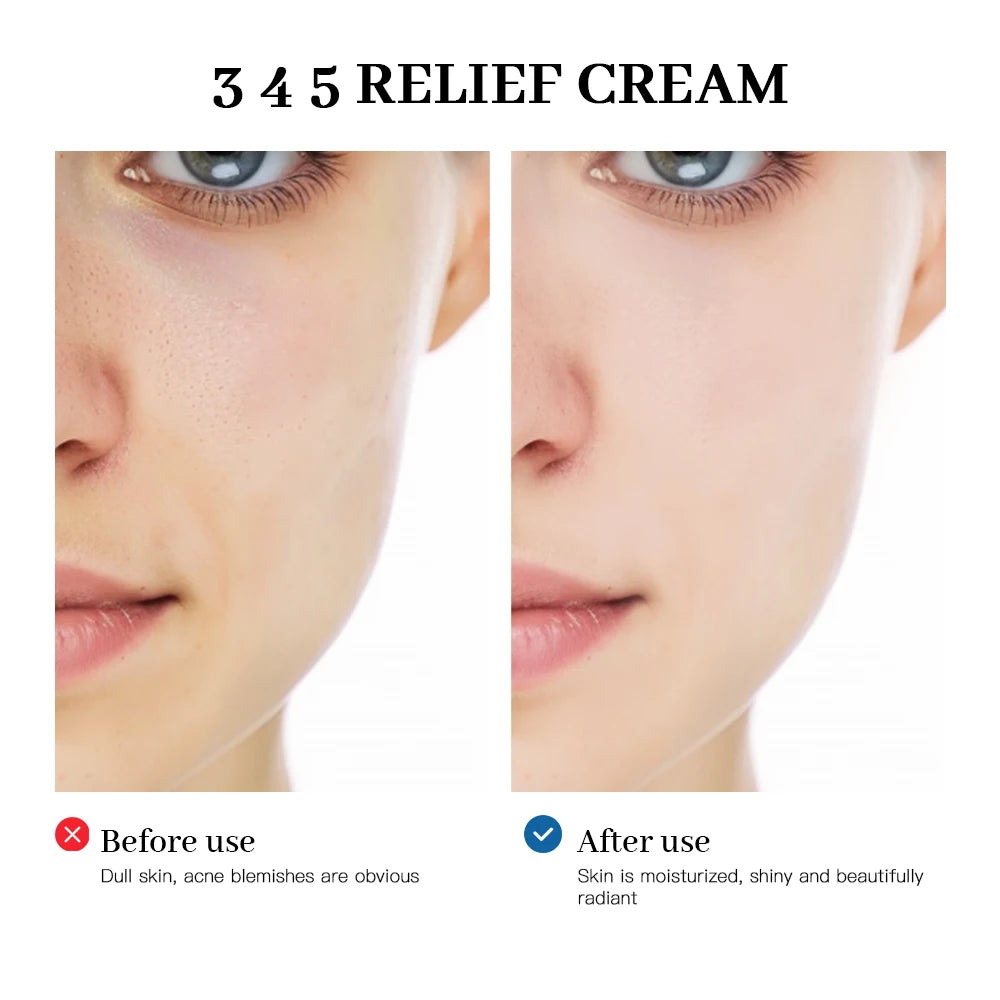 345 Relief Cream – Anti-Sugar Antioxidant Skin Repair | Brightening, Acne Mark Removal, Moisturizing & Oil-Control Face Cream (ibcccndc)