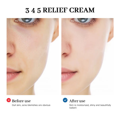 345 Relief Cream – Anti-Sugar Antioxidant Skin Repair | Brightening, Acne Mark Removal, Moisturizing & Oil-Control Face Cream (ibcccndc)